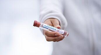 UAE Government Further Decreases The Price Of PCR Swab Tests