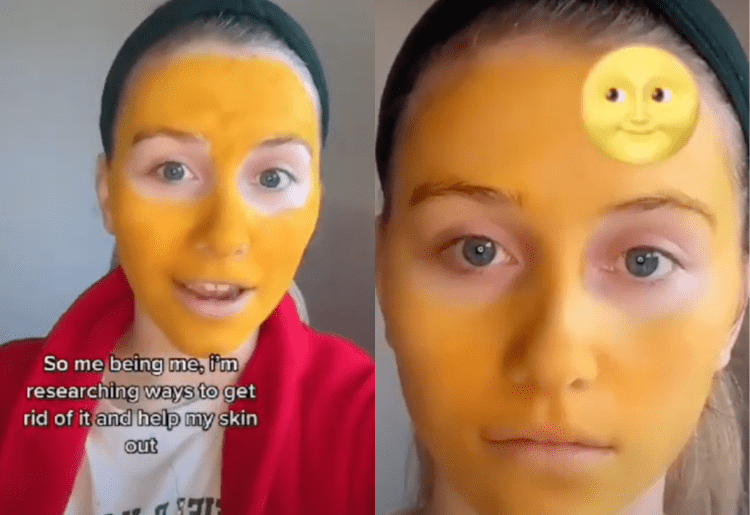 A Scottish Tiktoker Uses Turmeric Face Masks & The Results Are Shocking!