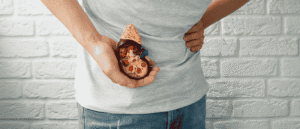 Summer Heat Raises Kidney Stone Risk: Warning Signs To Know