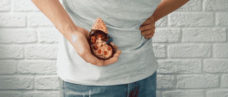 Summer Heat Raises Kidney Stone